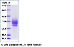 Sino Biological Recombinant Mouse Syndecan-2/CD362 Protein (His Tag), HPLC-verified,