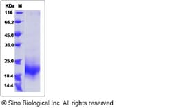 Sino Biological Recombinant Mouse GM-CSF/CSF2 Protein, Quantity: Each of