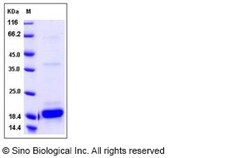 Sino Biological Mouse Interleukin-2 / IL-2 Protein 20ug, Quantity: Each