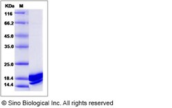 Sino Biological Recombinant Mouse IL-4 Protein (Q136D, Y139D, His Tag),