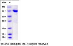 Sino Biological Recombinant Mouse TIE-2 Protein (aa 770-1122, His & GST
