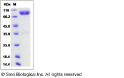 Sino Biological Recombinant Mouse IL1R2 Protein (hFc Tag), Quantity: Each