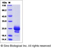 Sino Biological Recombinant Mouse IL-17F Protein (His Tag), Quantity: Each