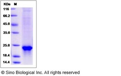 Sino Biological Recombinant Mouse Sonic Hedgehog/SHH Protein (His Tag),