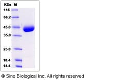 Sino Biological Recombinant Mouse IL-17RB Protein (His Tag), Quantity: