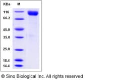 Sino Biological Recombinant Mouse CDCP1 Protein (His Tag), HPLC-verified,