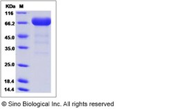 Sino Biological Recombinant Mouse EphA3 Protein (His Tag), HPLC-verified,