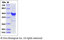 Sino Biological Mouse EphA3 Protein (aa 569-984) 50ug, Quantity: Each of