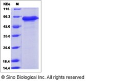 Sino Biological Mouse IGFBP7 / IBP-7 Protein (Fc Tag) 100ug, Quantity: