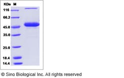 Sino Biological Mouse CD70 / CD27L / TNFSF7 Protein (Fc Tag) 50ug, Quantity:
