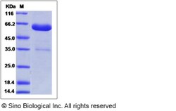 Sino Biological Recombinant Mouse ANTXR2 Protein (hFc Tag), Quantity: Each