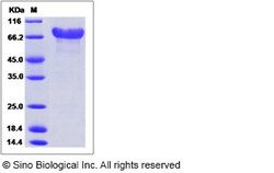 Sino Biological Mouse CD320 / 8D6A Protein (Fc Tag) 100ug, Quantity: Each