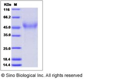 Sino Biological Mouse CD320 / 8D6A Protein (His Tag) 100ug, Quantity: Each