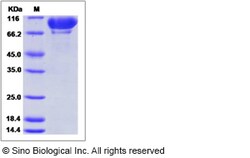 Sino Biological Recombinant Mouse Complement C2 Protein (His Tag), HPLC-verified,