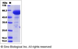 Sino Biological Mouse Complement Factor H Protein (His Tag) 50ug, Quantity: