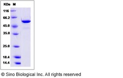 Sino Biological Recombinant Hamster FUT8 Protein (aa 68-575, His Tag),