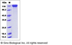 Sino Biological Recombinant Mouse Siglec-2/CD22 Protein (His Tag), HPLC-verified,