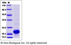 Sino Biological Recombinant Mouse IL-36 gamma/IL-1 F9 Protein (His Tag),