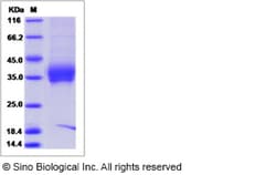 Sino Biological Mouse IL-4R / CD124 Protein (ECD, His Tag) 100ug, Quantity: