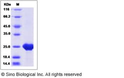 Sino Biological Recombinant Mouse CNTF Protein (His Tag), Quantity: Each