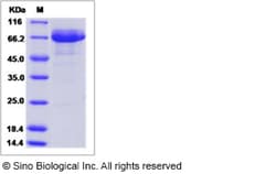 Sino Biological Recombinant Mouse EGF-L6 Protein (hFc Tag), Quantity: Each