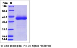 Sino Biological Mouse EGFL6 / EGF-L6 Protein (His Tag) 100ug, Quantity: