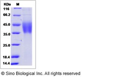 Sino Biological Mouse IL-21R / Il21R Protein (ECD, His Tag) 100ug, Quantity: