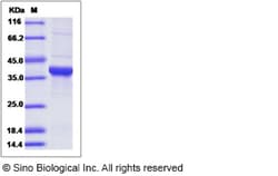 Sino Biological Recombinant Mouse GAPDH Protein (His Tag), Quantity: Each