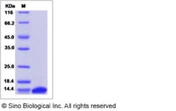 Sino Biological Recombinant Mouse FABP3/H-FABP Protein, Quantity: Each