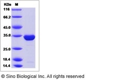 Sino Biological Recombinant Mouse SBDS Protein (His Tag), Quantity: Each