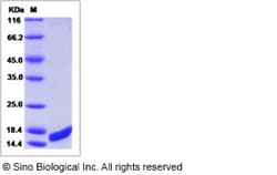Sino Biological Recombinant Mouse UBE2B Protein, Quantity: Each of 1