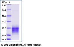 Sino Biological Recombinant Mouse IL-9 Protein (His Tag), Quantity: Each