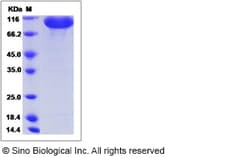 Sino Biological Recombinant Mouse EphB2 Protein (hFc Tag), Quantity: Each