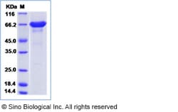 Sino Biological Recombinant Mouse ICA Protein (His Tag), Quantity: Each