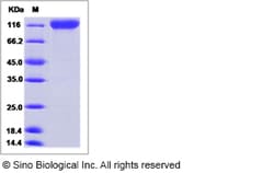 Sino Biological Recombinant Mouse MAG/Siglec-4a Protein (ECD, hFc Tag),