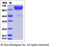 Sino Biological Recombinant Mouse MAG/Siglec-4a Protein (His Tag), HPLC-verified,
