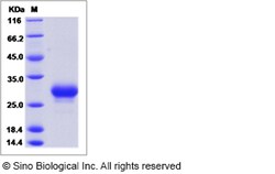 Sino Biological Mouse PTGDS / L-PGDS Protein (His Tag) 100ug, Quantity: