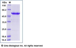 Sino Biological Mouse RBBP4 / RBAP48 Protein (His Tag) 50ug, Quantity: