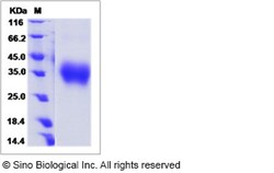 Sino Biological Recombinant Mouse VISTA/B7-H5 Protein (ECD, His Tag), HPLC-verified,
