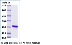 Sino Biological Recombinant Mouse Peroxiredoxin 2 Protein (His Tag), Quantity: