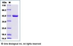 Sino Biological Recombinant Mouse IVD Protein (His Tag), Quantity: Each