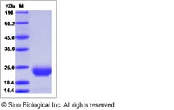 Sino Biological Recombinant Mouse CCDC47 Protein (His Tag), Quantity: Each