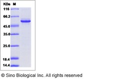 Sino Biological Recombinant Mouse GFOD2 Protein (His Tag), Quantity: Each