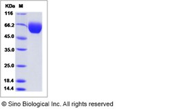 Sino Biological Recombinant Mouse IL1RAP/IL-1RAcP Protein (ECD, His Tag),