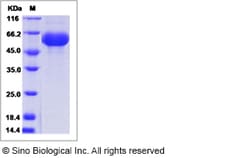 Sino Biological Mouse LAG3 / CD223 / Lymphocyte activation gene 3 Protein