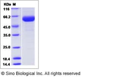 Sino Biological Mouse Calnexin / CANX Protein (His Tag) 100ug, Quantity: