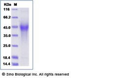 Sino Biological Recombinant Mouse CD44 Protein (His Tag), Quantity: Each