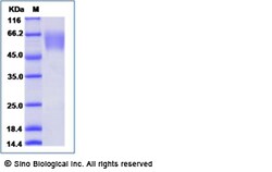 Sino Biological Recombinant Mouse CD47 Protein (rFc Tag), Quantity: Each