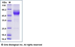 Sino Biological Mouse GITR / TNFRSF18 Protein (Fc Tag) 100ug, Quantity: