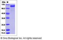 Sino Biological Recombinant Mouse GAS6 Protein (His Tag), HPLC-verified,
